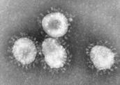 Virus